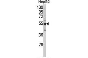 Western blot analysis of CYP2J2 Antibody (N-term) in HepG2 cell line lysates (35ug/lane). (CYP2J2 抗体  (N-Term))