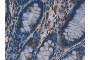 Immunohistochemistry (IHC) image for anti-Vav 3 Oncogene (VAV3) (AA 183-380) antibody (ABIN7437782)
