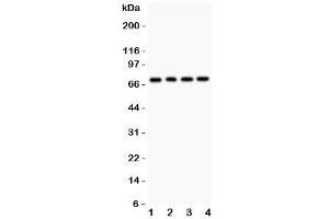 Western blot testing of FOXO1 antibody and Lane 1:  rat lung (FOXO1 抗体  (AA 456-655))