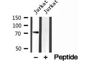 Western blot analysis of extracts of Jurkat cells, using VISA antibody. (MAVS 抗体  (C-Term))