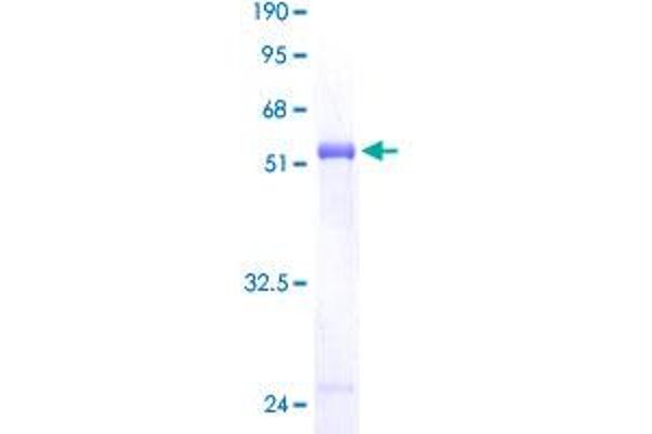 PCTP Protein (AA 1-214) (GST tag)