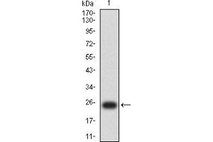 Western Blotting (WB) image for anti-Prosaposin (PSAP) (AA 17-216) antibody (ABIN7193617)
