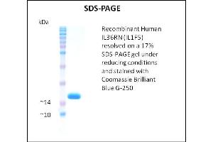 SDS-PAGE (SDS) image for Interleukin 1 delta (FIL1d) (Active) protein (ABIN5510059)