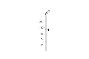 Western Blot at 1:1000 dilution + Jurkat whole cell lysate Lysates/proteins at 20 ug per lane. (TAO Kinase 1 (TAOK1) (AA 620-650) 抗体)