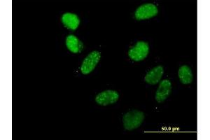 Immunofluorescence of purified MaxPab antibody to C20orf20 on HeLa cell. (MRGBP 抗体  (AA 1-204))