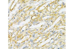 Immunohistochemistry (Paraffin-embedded Sections) (IHC (p)) image for anti-Sulfotransferase Family, Cytosolic, 2A, Dehydroepiandrosterone (DHEA)-Preferring, Member 1 (SULT2A1) antibody (ABIN7008595)