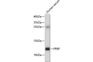 Western blot analysis of extracts of Human serum using PPBP Polyclonal Antibody at dilution of 1:1000. (CXCL7 抗体)