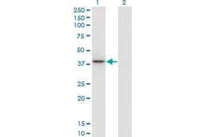 Western Blot analysis of PARVG expression in transfected 293T cell line by PARVG monoclonal antibody (M01A), clone 4E1. (PARVG 抗体  (AA 1-331))
