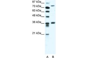 WB Suggested Anti-MID1 Antibody Titration:  2. (MID1 抗体  (C-Term))