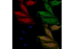 ABIN6264389 and ABIN6279692 staining  cells by IF/ICC. (PPP1R3D 抗体  (Internal Region))