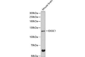 Western blot analysis of extracts of mouse brain, using EXOC1 Antibody (ABIN6129575, ABIN6140361, ABIN6140362 and ABIN6224778) at 1:3000 dilution. (EXOC1 抗体  (AA 645-894))