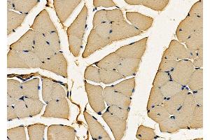 ABIN6262013 and ABIN6277958 at 1/100 staining Mouse muscle tissue by IHC-P.