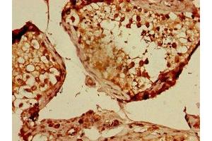 Immunohistochemistry of paraffin-embedded human testis tissue using ABIN7148749 at dilution of 1:100 (Cullin 2 抗体  (AA 591-742))