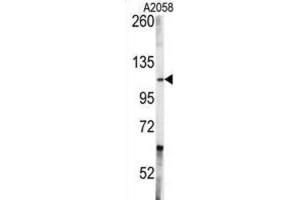 Western Blotting (WB) image for anti-C-Abl Oncogene 1, Non-Receptor tyrosine Kinase (ABL1) antibody (ABIN3003438) (ABL1 抗体)