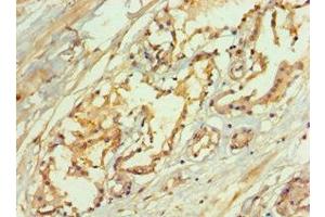 Immunohistochemistry of paraffin-embedded human prostate tissue using ABIN7167072 at dilution of 1:100 (MAPKSP1 抗体  (AA 1-124))