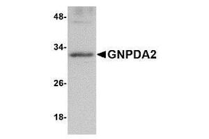 Western blot analysis of GNPDA2 in human kidney lysate with AP30369PU-N GNPDA2 antibody at 1 μg/ml. (GNPDA2 抗体  (C-Term))