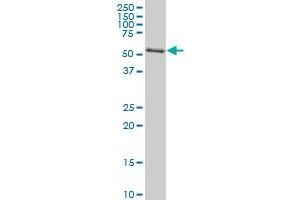 AKT2 monoclonal antibody (M04A), clone 1F8 Western Blot analysis of AKT2 expression in Jurkat . (AKT2 抗体  (AA 100-189))