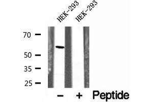 Western blot analysis of extracts of HEK-293 cells, using UGT2B7 antibody. (UGT2B7 抗体)
