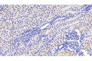Detection of CASP2 in Human Kidney Tissue using Polyclonal Antibody to Caspase 2 (CASP2) (Caspase 2 抗体  (AA 334-452))
