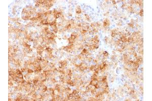 Formalin-fixed, paraffin-embedded human Parathyroid stained with Chromogranin A Rabbit Polyclonal Antibody. (Chromogranin A 抗体)