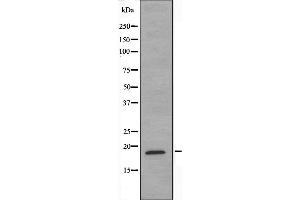 Western blot analysis of extracts from COLO205 cells, using NCBP2 antibody. (NCBP2 抗体  (N-Term))