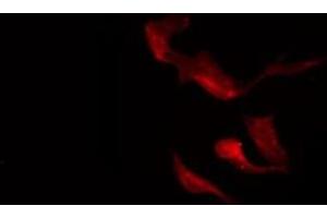 ABIN6275366 staining A549 by IF/ICC. (nectin-3 抗体  (Internal Region))
