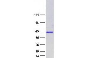 Western Blotting (WB) image for Poly(rC) Binding Protein 2 (PCBP2) (Transcript Variant 6) protein (Myc-DYKDDDDK Tag) (ABIN2728356)