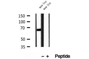 Western blot analysis of extracts of mouse liver tissue, using TOM70 antibody. (TOM70 抗体  (C-Term))