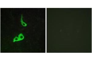 Immunofluorescence analysis of LOVO cells, using GPR153 Antibody. (GPR153 抗体  (AA 195-244))