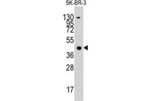 Western Blotting (WB) image for anti-Acetyl-CoA Acetyltransferase 1 (ACAT1) antibody (ABIN3003291) (ACAT1 抗体)