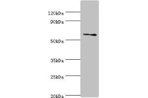 Western blot All lanes: DHCR24 antibody at 2 μg/mL + Jurkat whole cell lysate Secondary Goat polyclonal to rabbit IgG at 1/10000 dilution Predicted band size: 61, 55 kDa Observed band size: 61 kDa (Seladin 1 抗体  (AA 227-516))