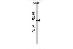 Image no. 1 for anti-Cyclin E1 (CCNE1) (C-Term) antibody (ABIN358767) (Cyclin E1 抗体  (C-Term))