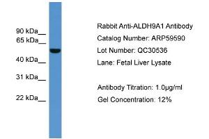WB Suggested Anti-ALDH9A1  Antibody Titration: 0. (ALDH9A1 抗体  (C-Term))