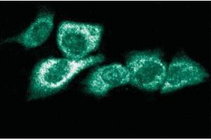 Immunofluorescent staining of Hs 766T cells. (RPS6KA1 抗体  (AA 1-184))