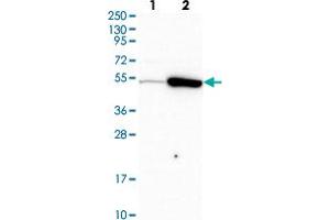 Western blot analysis of Lane 1: Human cell line RT-4 Lane 2: Human cell line U-251MG sp with TRIP6 polyclonal antibody  at 1:500-1:1000 dilution. (TRIP6 抗体)