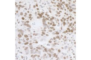 Immunohistochemistry (IHC) image for anti-Fused in Sarcoma (FUS) (AA 1-50) antibody (ABIN7454607) (FUS 抗体  (AA 1-50))