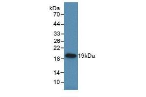 Detection of Recombinant HSPb6, Rat using Monoclonal Antibody to Heat Shock Protein Beta 6 (HSPb6) (HSPB6 抗体  (AA 1-162))
