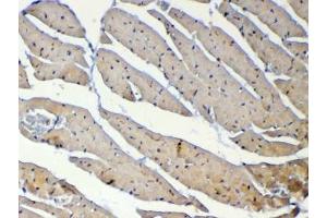IHC testing of FFPE mouse heart tissue with Dnmt1 antibody at 1ug/ml. (DNMT1 抗体)