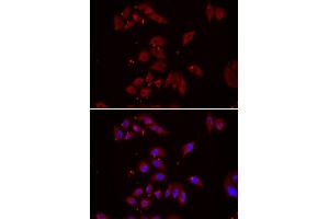 Immunofluorescence analysis of U2OS cell using NPHP1 antibody. (NPHP1 抗体)