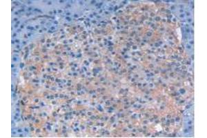 IHC-P analysis of Human Pancreas Tissue, with DAB staining. (LIF 抗体  (AA 2-201))