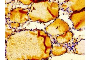 Immunohistochemistry of paraffin-embedded human thyroid tissue using ABIN7156373 at dilution of 1:100 (IGFBP6 抗体  (AA 32-161))