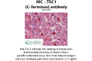 Image no. 1 for anti-Tuberous Sclerosis 1 (TSC1) (C-Term) antibody (ABIN1740408) (TSC1 抗体  (C-Term))