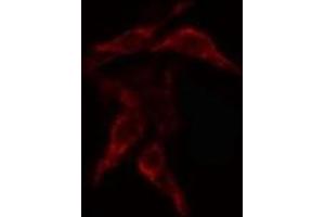 ABIN6268812 staining Hela cells by IF/ICC. (COL4a2 抗体  (N-Term))