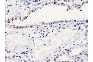 Immunohistochemistry (IHC) image for anti-Integral Membrane Protein 2B (ITM2B) antibody (ABIN1496395) (ITM2B 抗体)