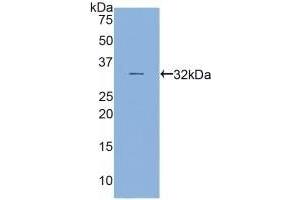Detection of Recombinant MYH16, Human using Polyclonal Antibody to Myosin Heavy Chain 16 (MYH16) (MYH16 抗体  (AA 209-469))