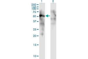 Western Blot analysis of FOXD1 expression in transfected 293T cell line by FOXD1 monoclonal antibody (M01), clone 2C10. (FOXD1 抗体  (AA 1-91))