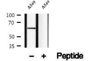Western blot analysis of extracts of A549 cells, using Phospho-SQSTM1/p62 (Thr269/Ser272) Antibody.
