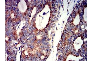 Immunohistochemistry (IHC) image for anti-Cholinergic Receptor, Nicotinic, alpha 7 (Neuronal) (CHRNA7) (AA 52-259) antibody (ABIN5611363)
