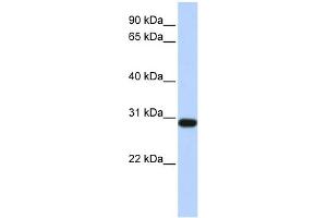 WB Suggested Anti-BPGM Antibody Titration: 0. (BPGM 抗体  (Middle Region))
