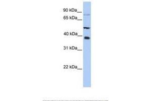 Image no. 1 for anti-Methyltransferase Like 2B (METTL2B) (N-Term) antibody (ABIN6738511) (METTL2B 抗体  (N-Term))